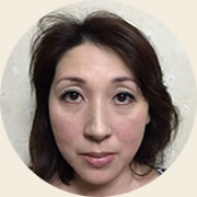 一度でほうれい線が薄く短く！